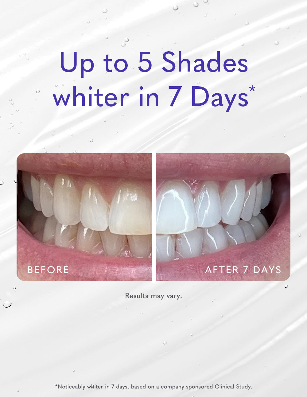 teeth whitening pen before and after up to 5 shades whiter in 7 days